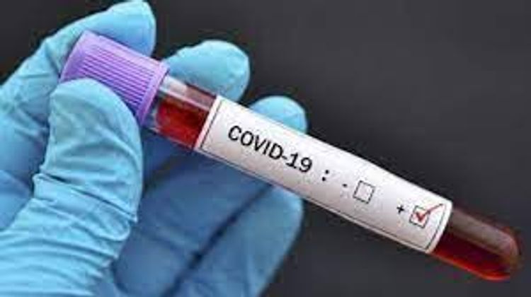Number of confirmed coronavirus cases reaches 321 798 in Azerbaijan, 4580 death cases