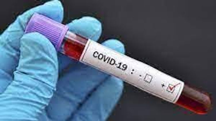 3 289 864 coronavirus tests conducted in Azerbaijan so far