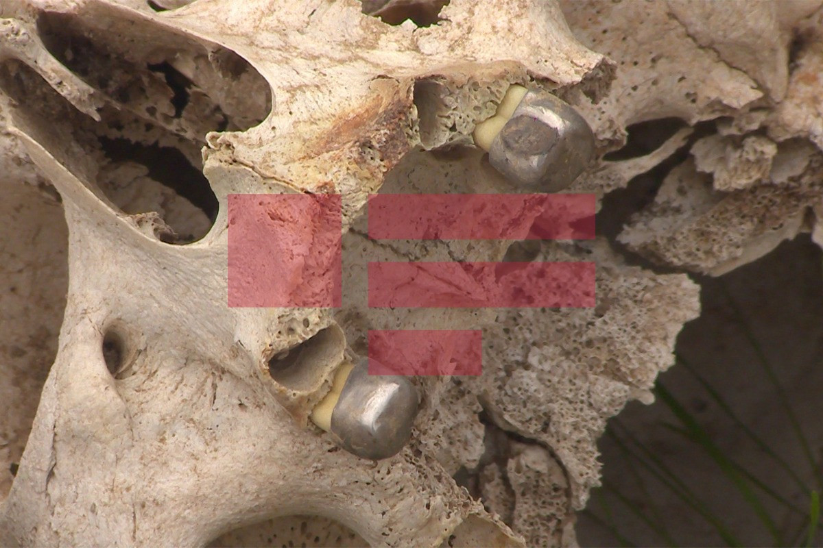 Another proof of Armenian vandalism: cemetery destroyed in Jabrayil, golden teeth of bodies were removed-PHOTO 