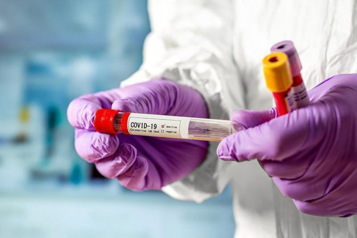 Decline in COVID cases invites appearance of strains unaffected by antibodies