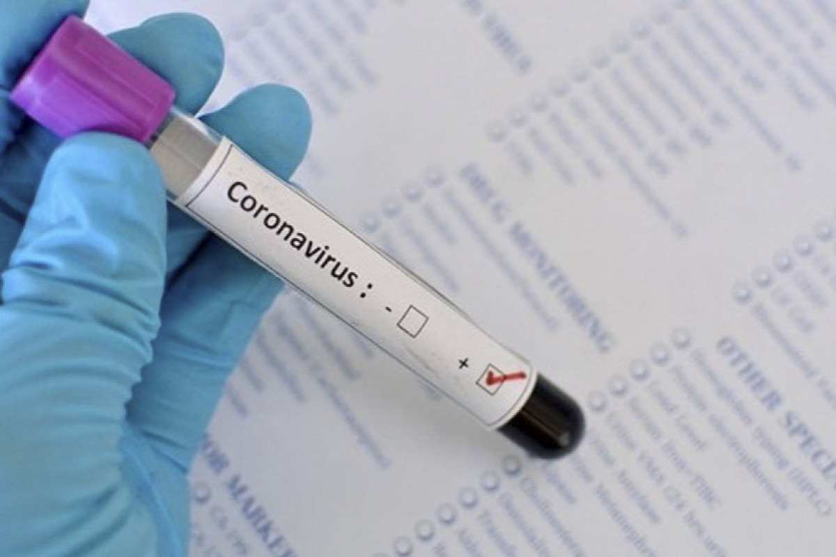 Armenia's coronavirus death toll reach 7,485