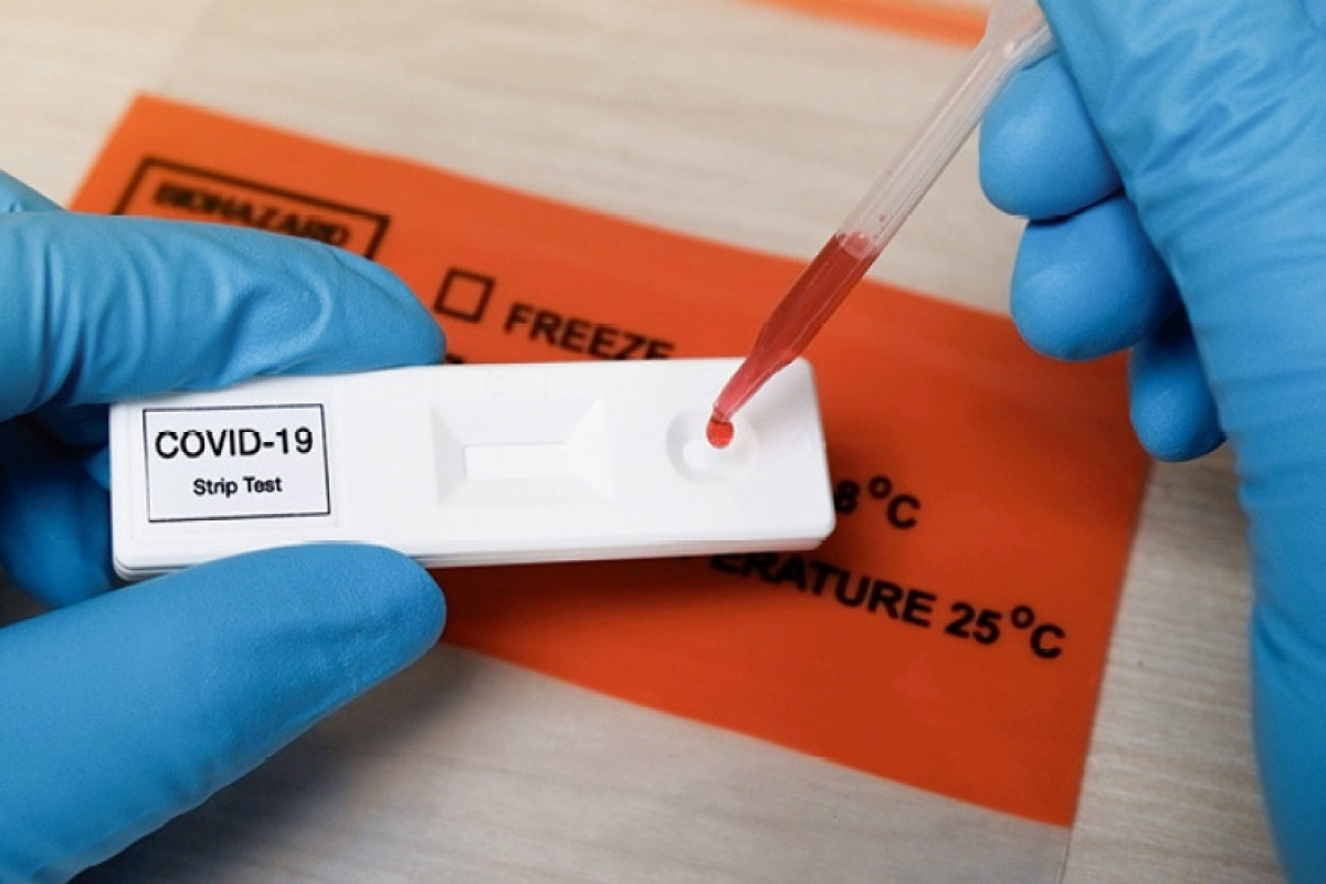 Moscow to conduct mandatory tests for COVID-19 antigen among those with SARS symptoms