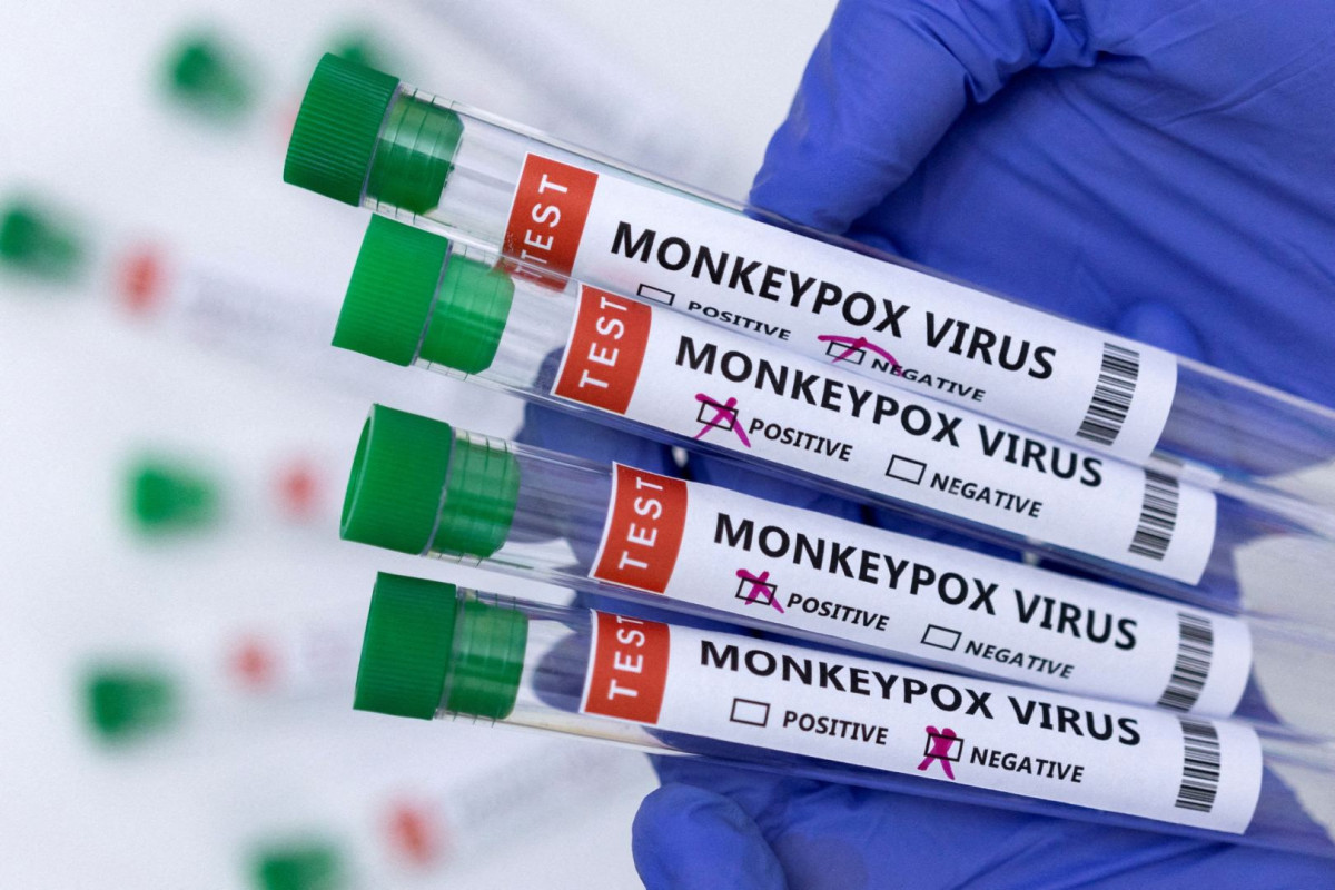 Germany records first case of monkeypox in child