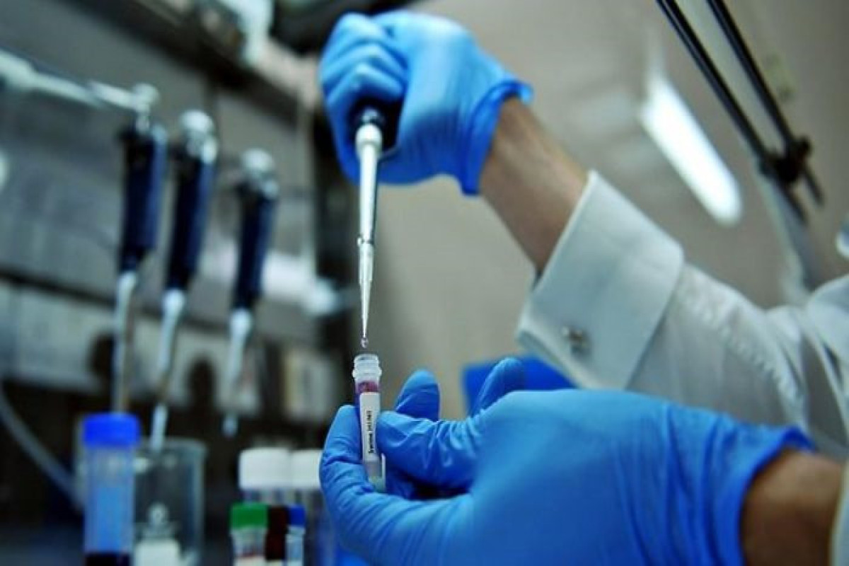 Swine flu is rapidly increasing in Armenia