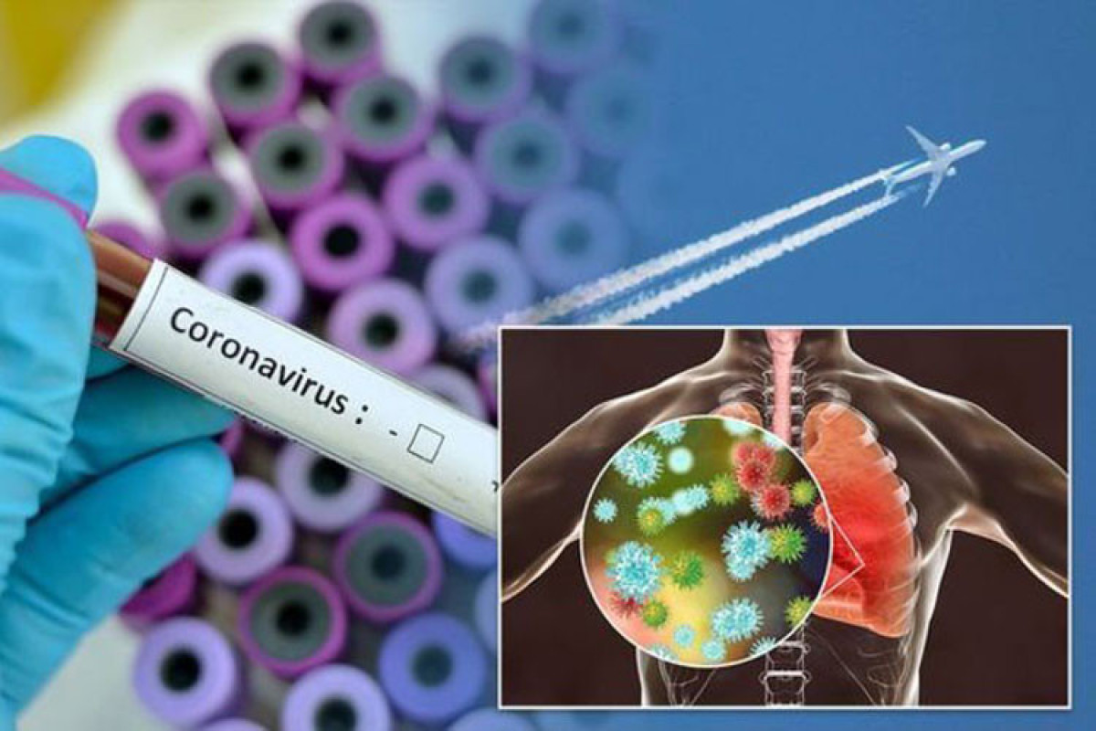 Azerbaijan logs 90 fresh coronavirus cases