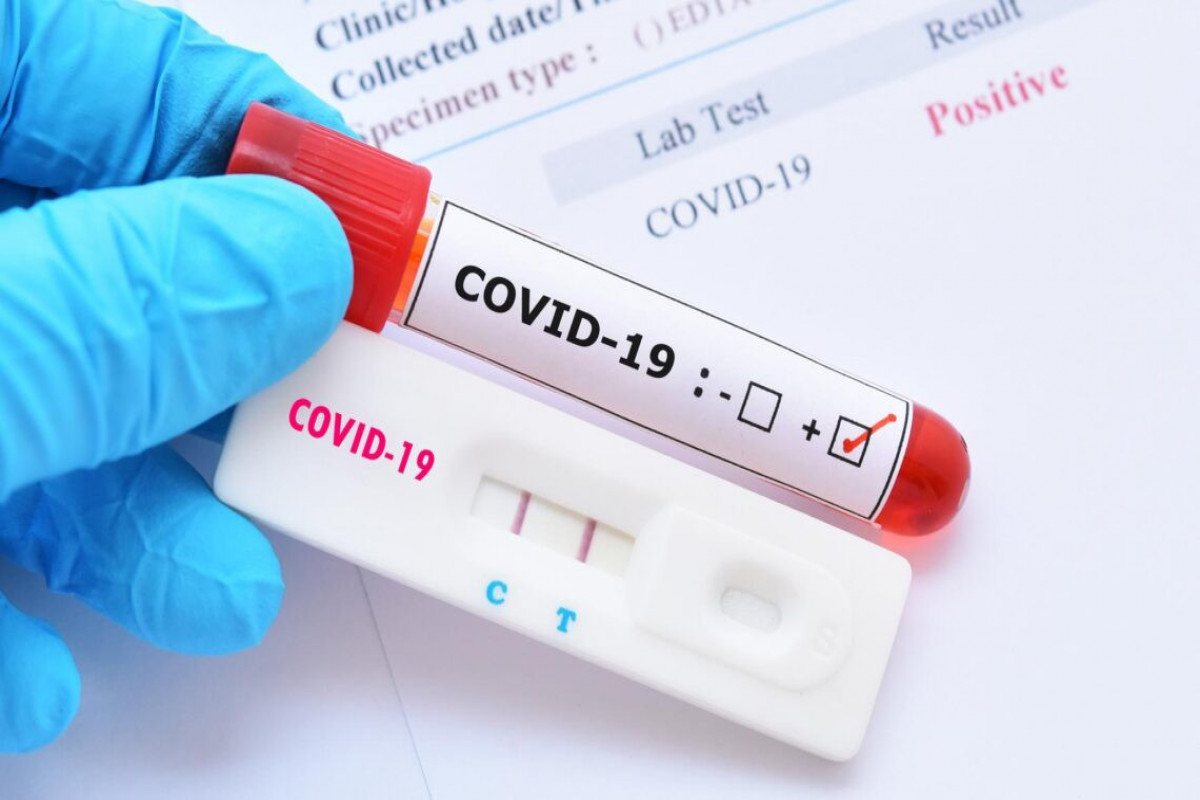 Azerbaijan logs 364 fresh COVID-19 cases, 7 deaths