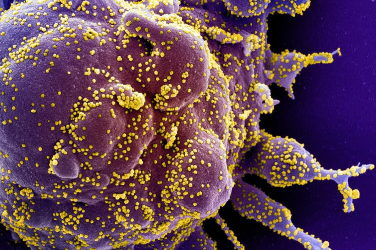 France detects new Coronavirus strain