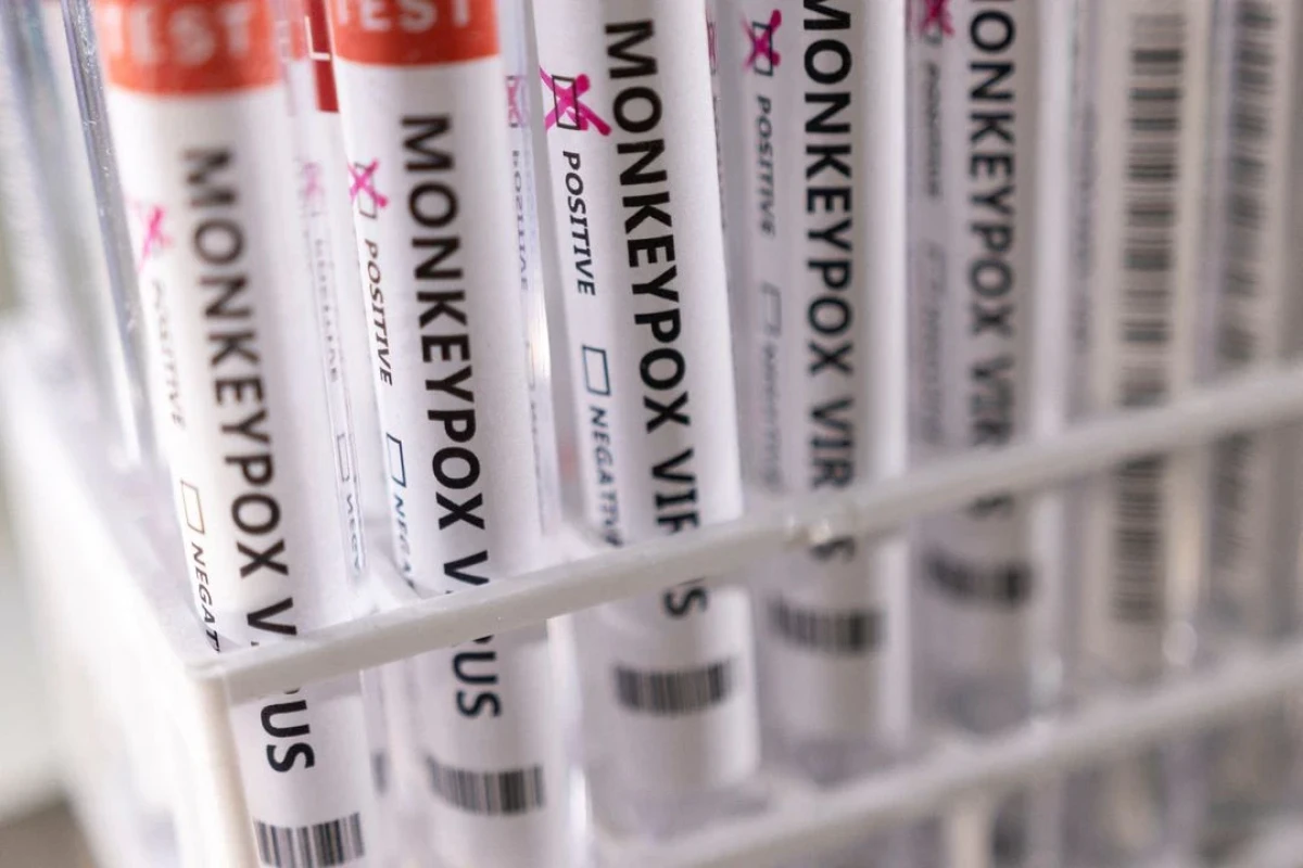 South Africa confirms third monkeypox case in tourist from Switzerland