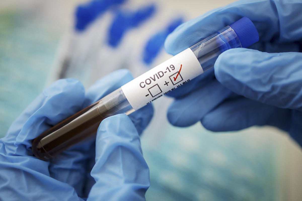 Global coronavirus tally tops 569 million