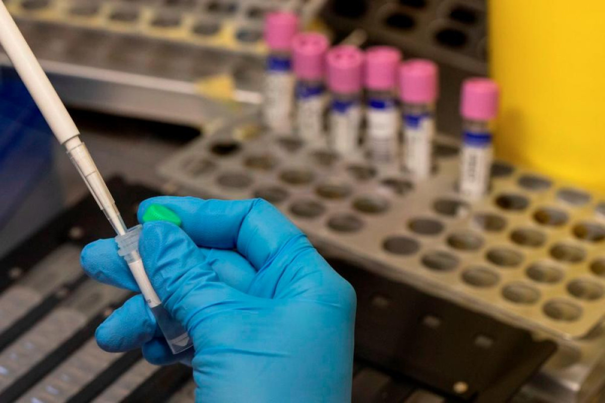 Japan detects first monkeypox case