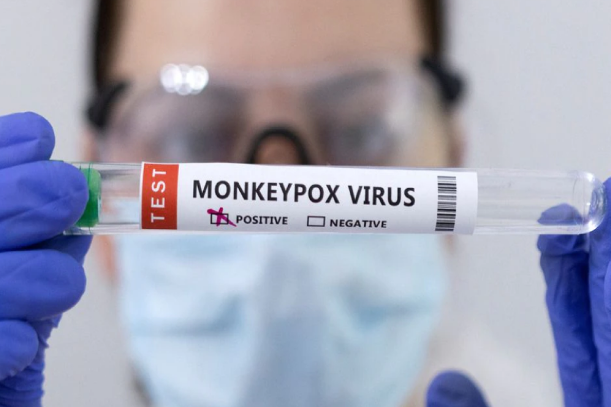 Brazil reports first monkeypox death outside Africa in current outbreak