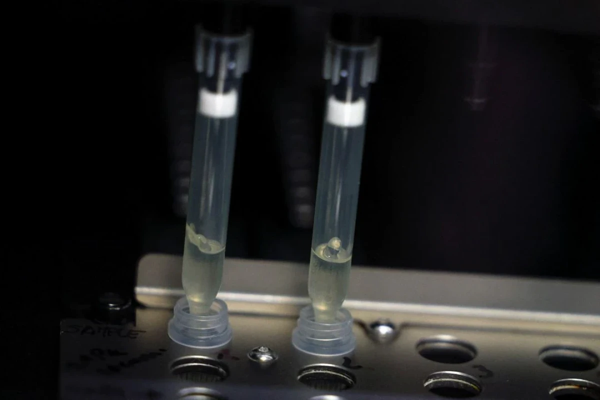 Spain reports second monkeypox-related death in Europe