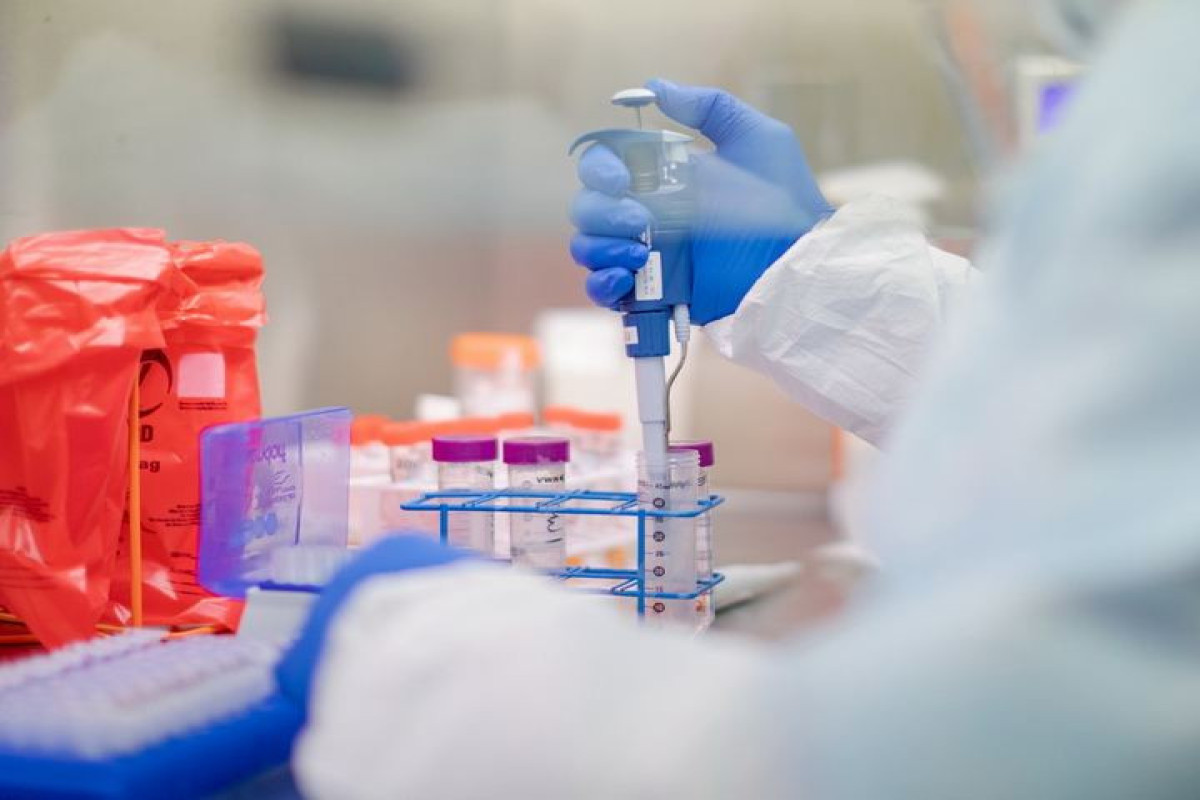 Azerbaijan to receive tests on monkeypox in coming days