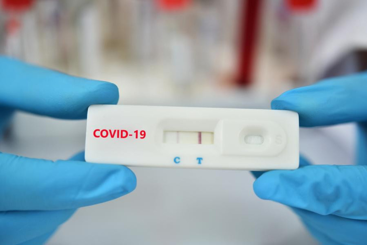 Azerbaijan logs 29 new COVID-19 cases