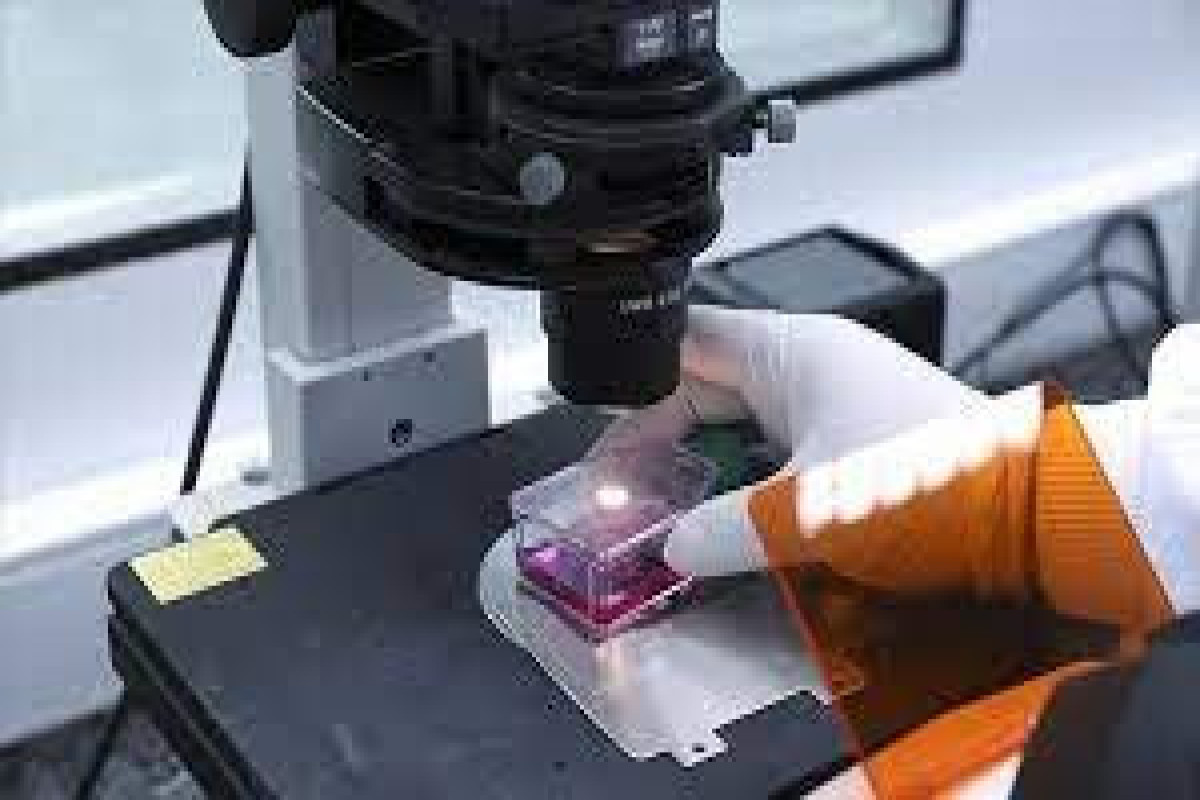 Norway warns of possible monkeypox infections in Oslo