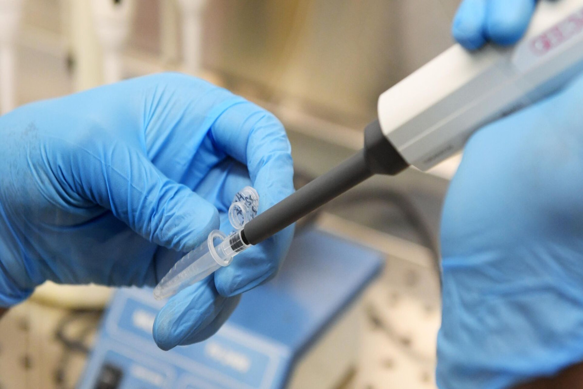 Five more monkeypox cases  confirmed in the U.S.