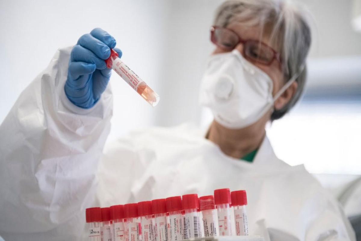 Number of people with monkeypox in UK jumps to 78