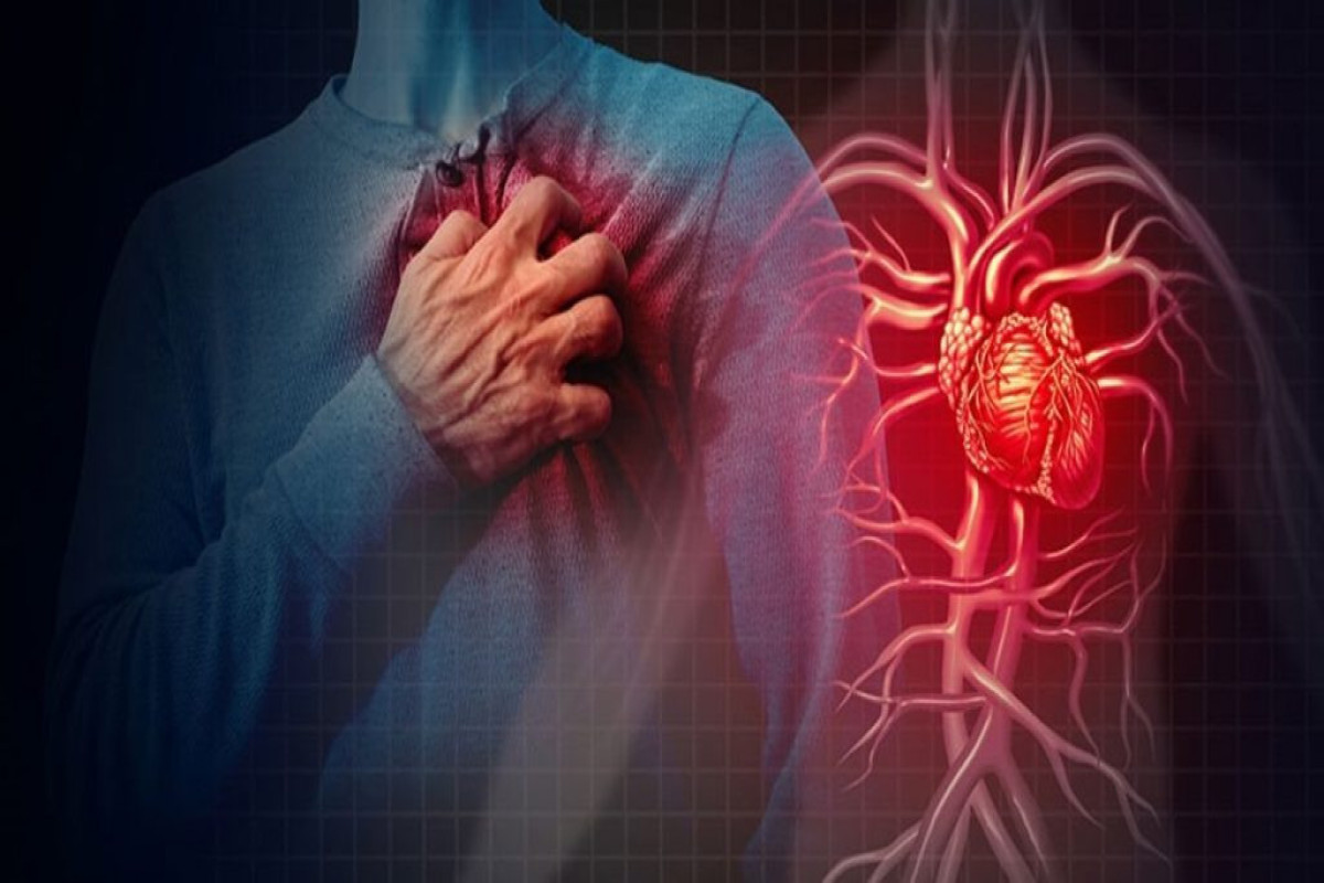 Cardiovascular diseases cause 60% of deaths in Azerbaijan - ASC chairman