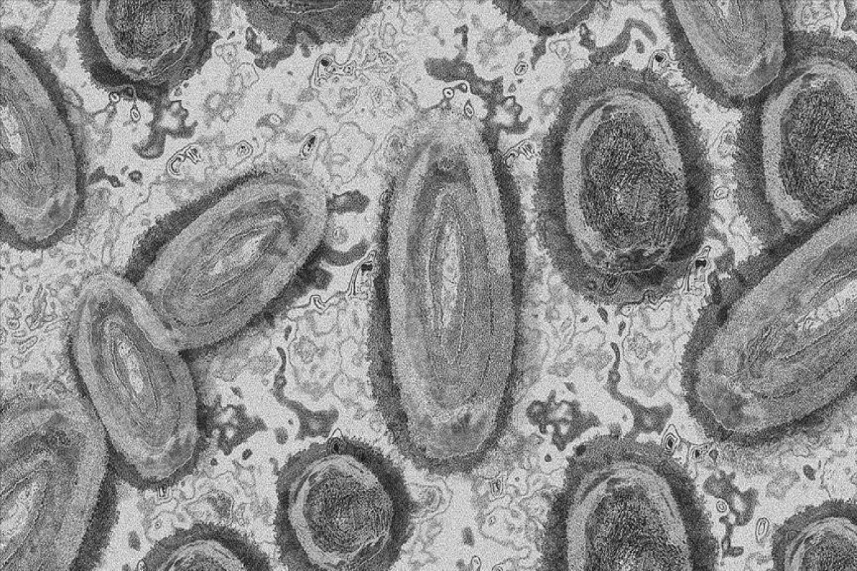 WHO tracking new EG.5 coronavirus variant