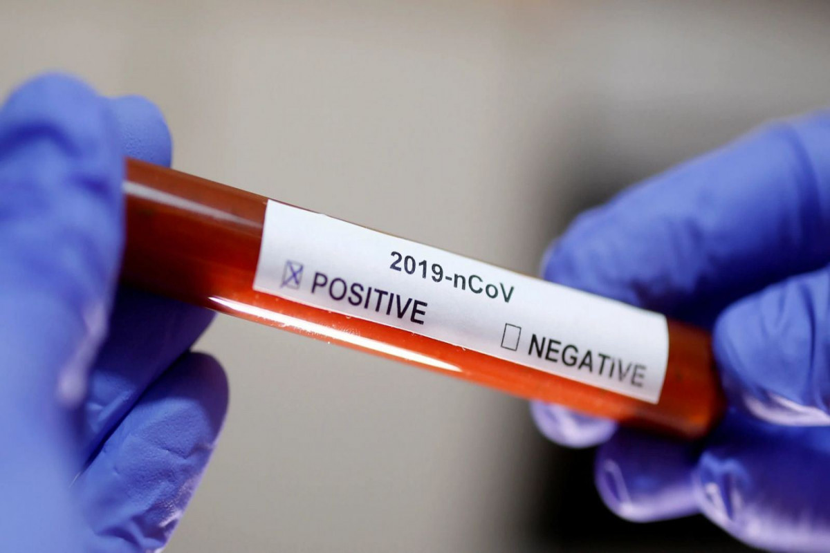 Azerbaijan updates number of COVID-19 infections