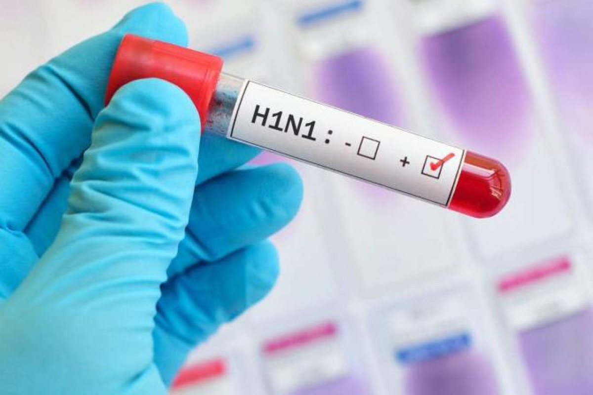 Two died from swine flu in Armenia