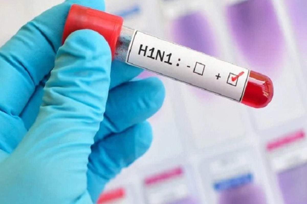 Azerbaijan's Ministry of Health: Epidemiological situation regarding swine flu is closely followed