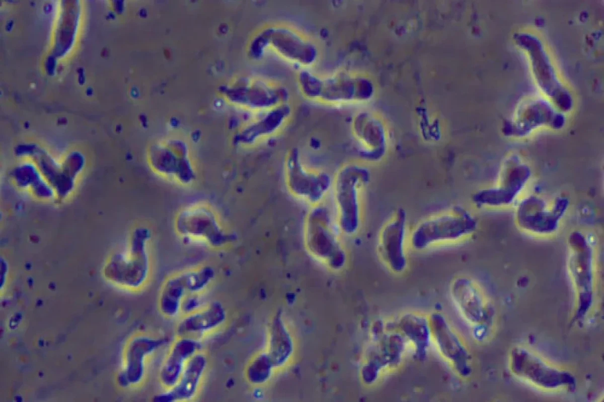 Georgia resident becomes third in US killed by ‘brain-eating amoeba’ in 2023