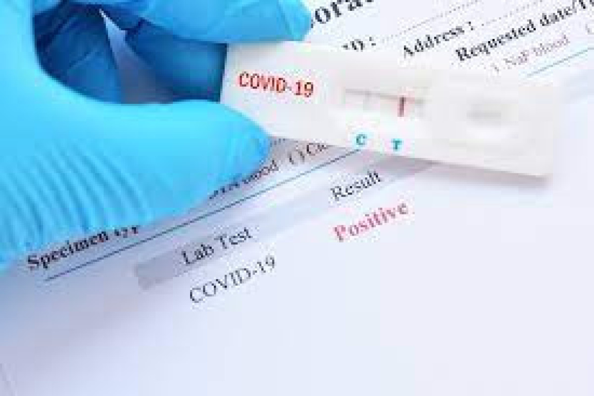 Azerbaijan confirms 4 more COVID-19 cases, 7 recoveries