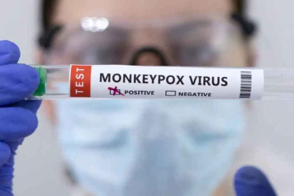 WHO says mpox is no longer a global health emergency
