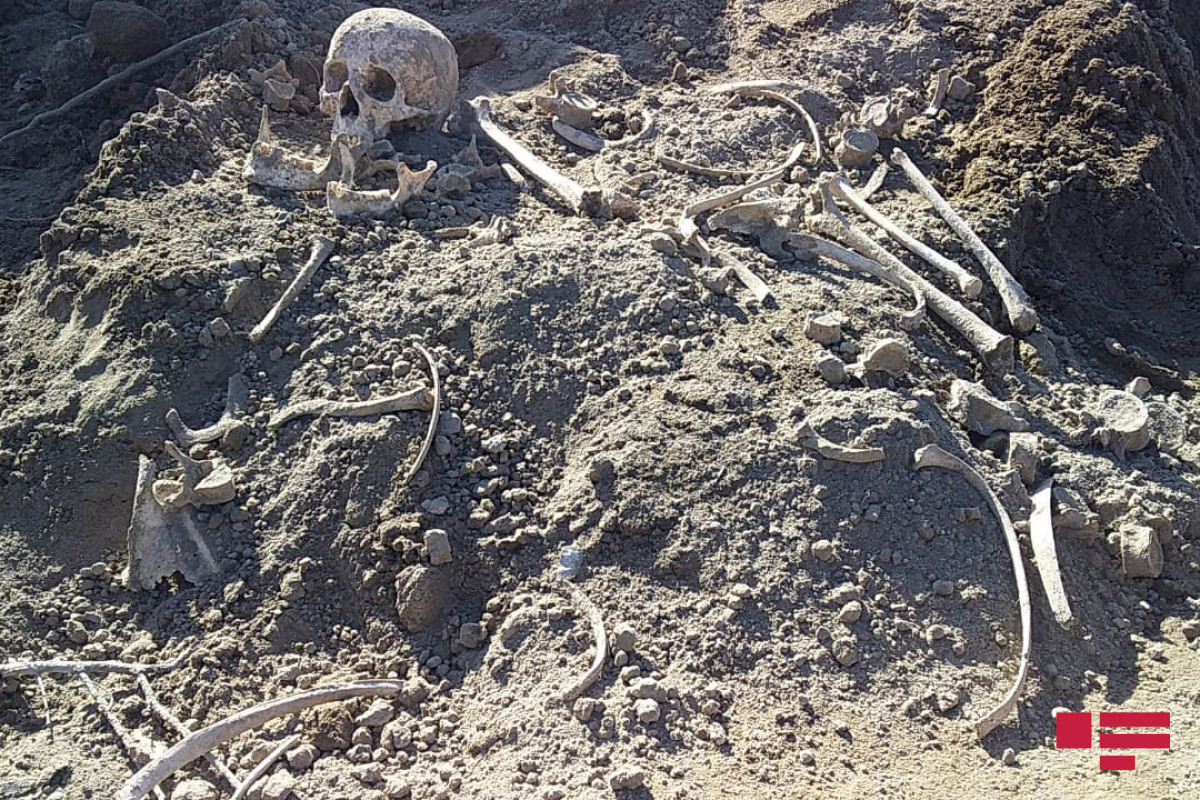 A skull belonging to a human discovered in liberated area of Aghdam - Vimarsana News