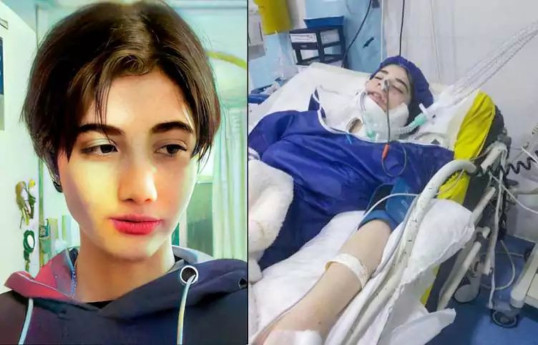 Iranian teen allegedly attacked by morality police for not wearing hijab dies