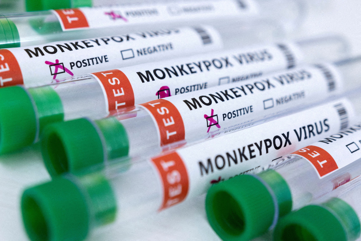 China to manage monkeypox as disease on par with COVID-19