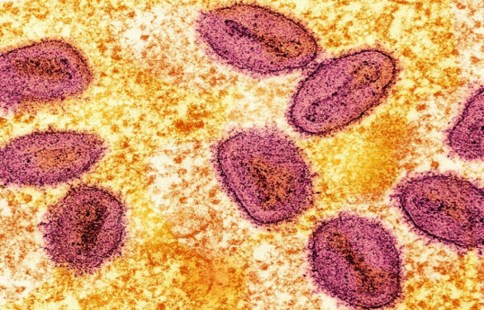 Philippines detects first mpox case this year