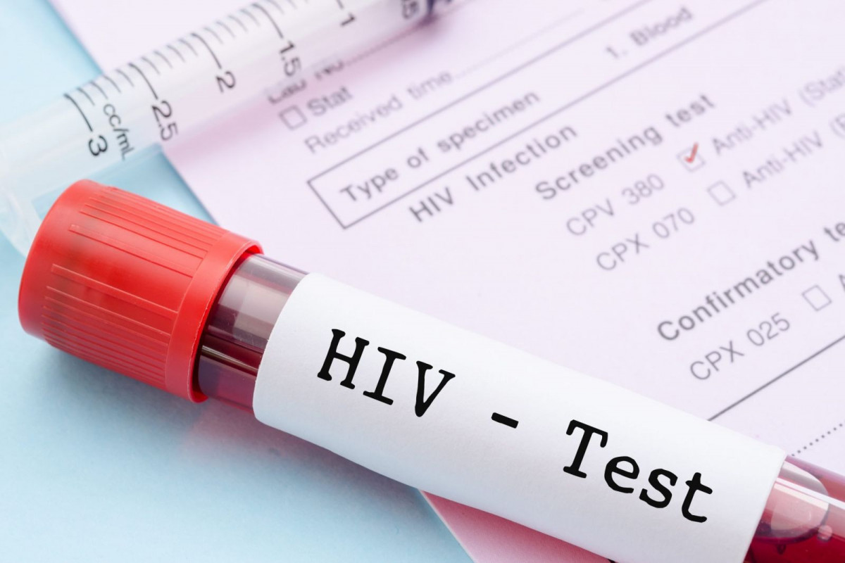 Number of people infected with HIV has been reduced by 2 times in Azerbaijan, ministry says - Vimarsana News