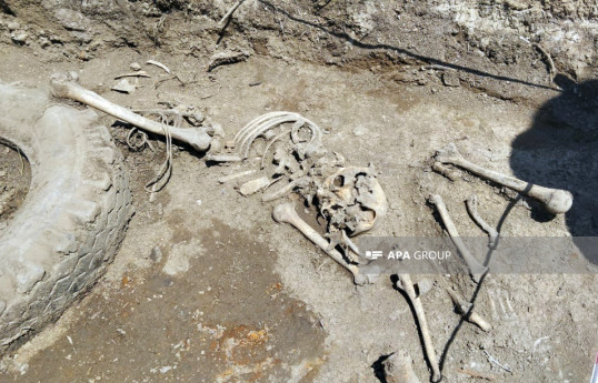 Remains of another child removed from mass grave found in Khojaly