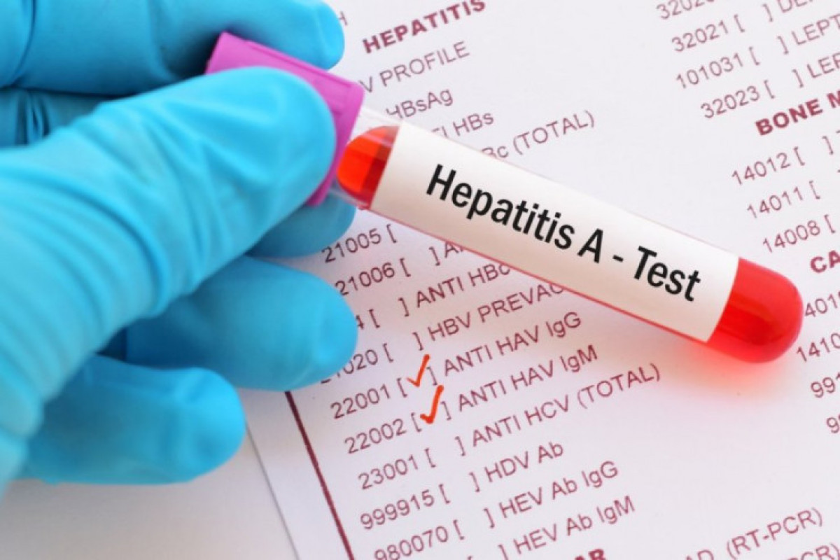 Children aged 5-14 more often infected with Hepatitis A - Health Ministry