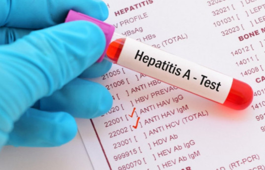 Children aged 5-14 more often infected with Hepatitis A - Health Ministry