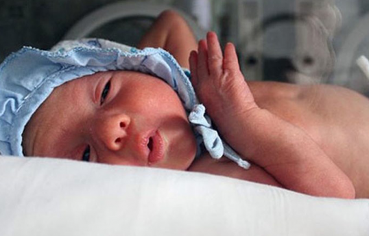 Ministry: Birth defects in children have increased