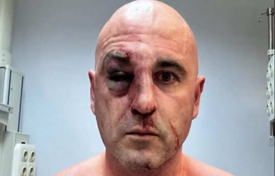 Leader of Georgia’s largest opposition party beaten by police at rally
