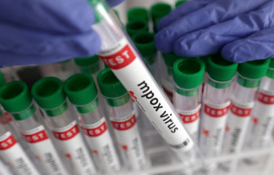 India reports 3rd case of mpox