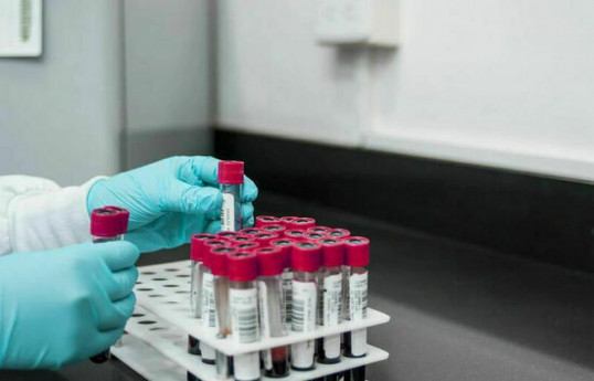 First case of monkeypox reported in Russia