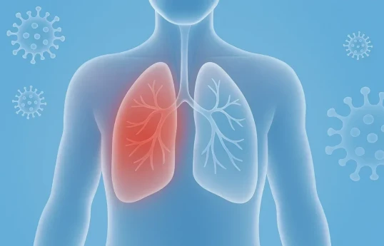Azerbaijan Ministry of Health: Seasonal respiratory infections increase pneumonia risk