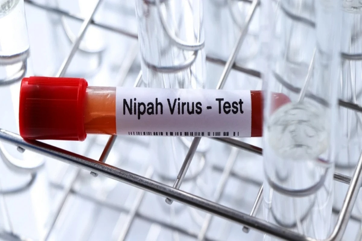 No Nipah virus detected in Georgia