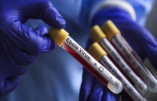 Health Ministry: Ebola is not endemic to Azerbaijan and the risk of its spread is low