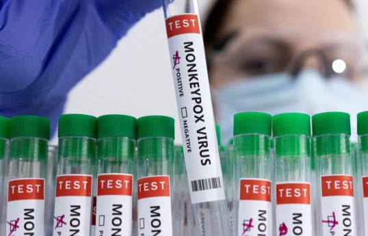 New case of monkeypox recorded in Russia