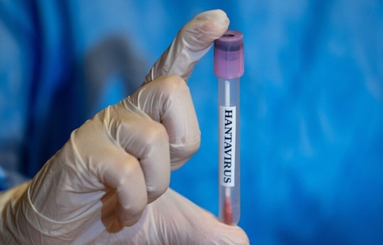 Test results of three Turkish citizens evacuated from hantavirus-detected ship come back negative