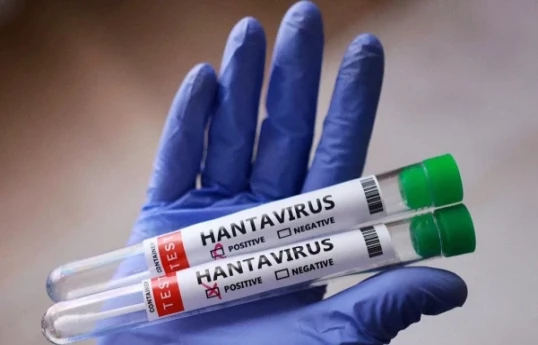 WHO: Azerbaijan has capability to test for hantavirus via PCR, risk of spread remains low