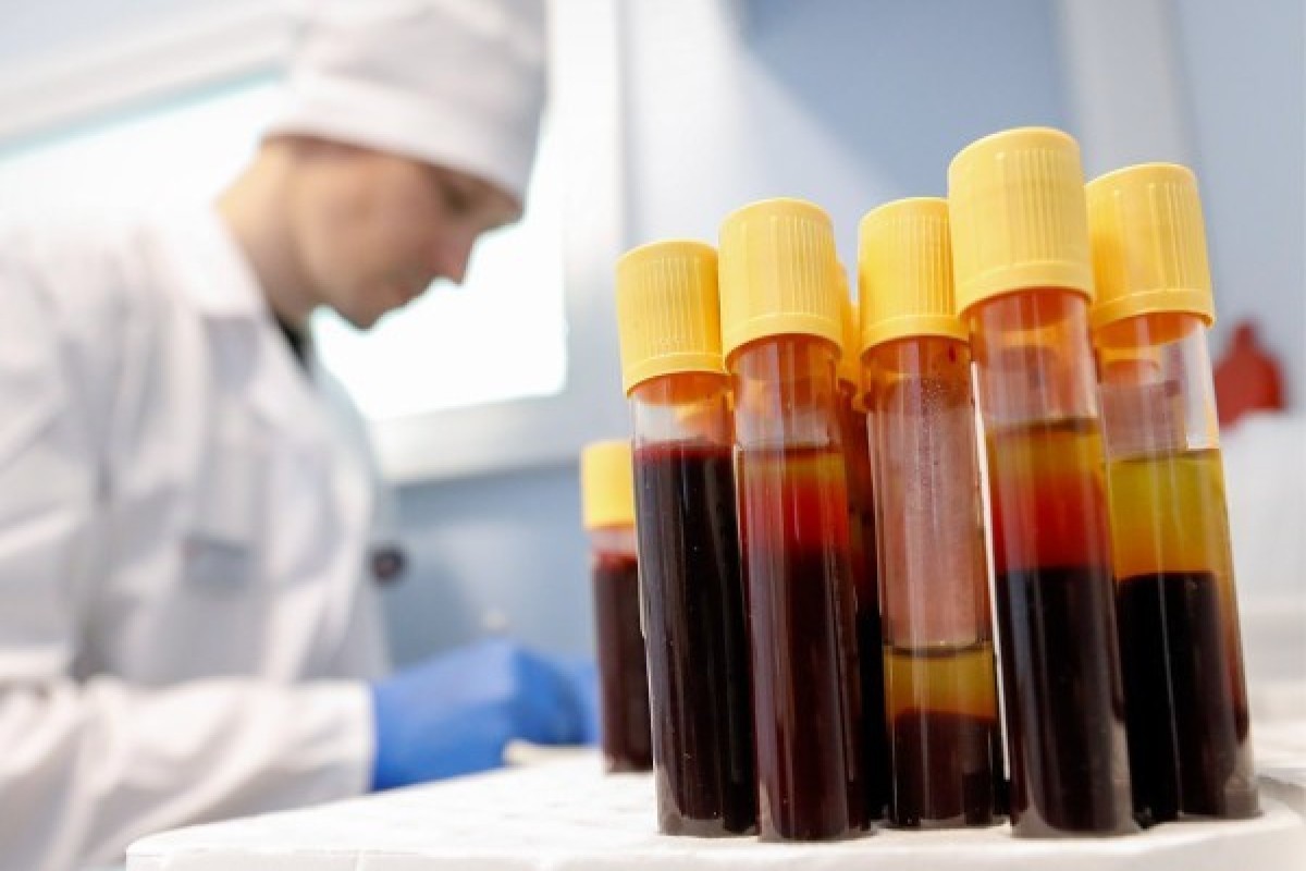 Russia reports generalized HIV epidemic in 30 regions